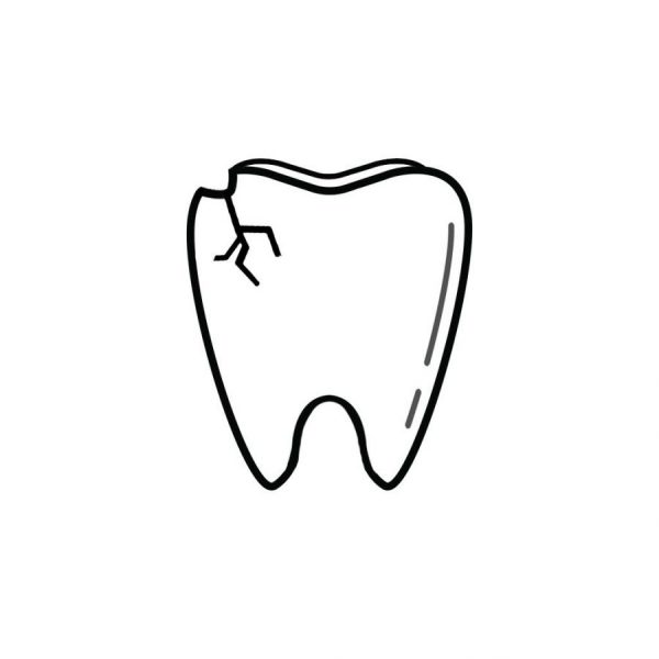 98226 Dentist | I Chipped a Tooth! What Can I Do?