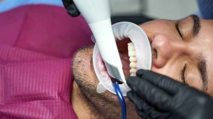 Do Teeth Whiteners Really Work? What Dentists Want You to Know