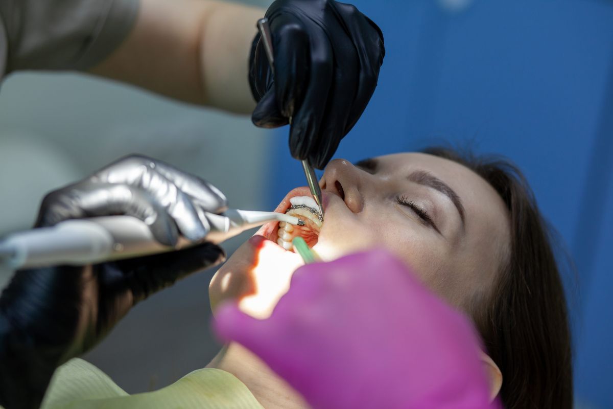 What to Do After Tooth Extraction: A Complete Recovery Guide