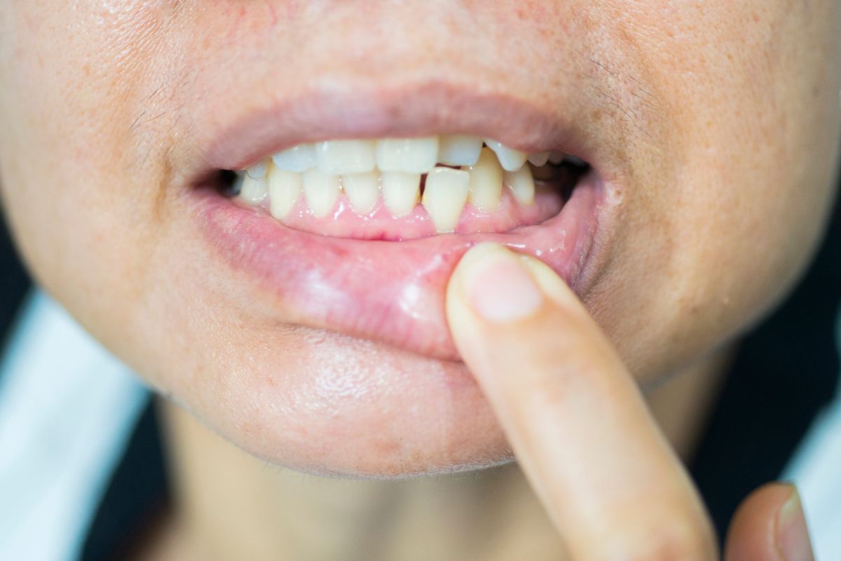 gum disease treatment